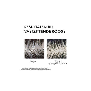 Vichy Dercos Technique Anti-Roos DS Shampoo - Normaal tot Vet haar - 200ml - Vichy | L'Oréal Dermatological Beauty Partner Shop
