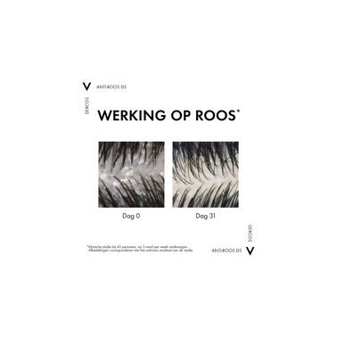 Vichy Dercos Technique Anti-Roos DS Shampoo - Droog haar - 200ml - Vichy | L'Oréal Dermatological Beauty Partner Shop